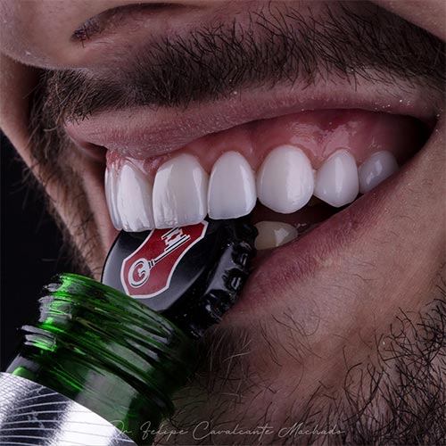 Imagem diferenciais dr implante